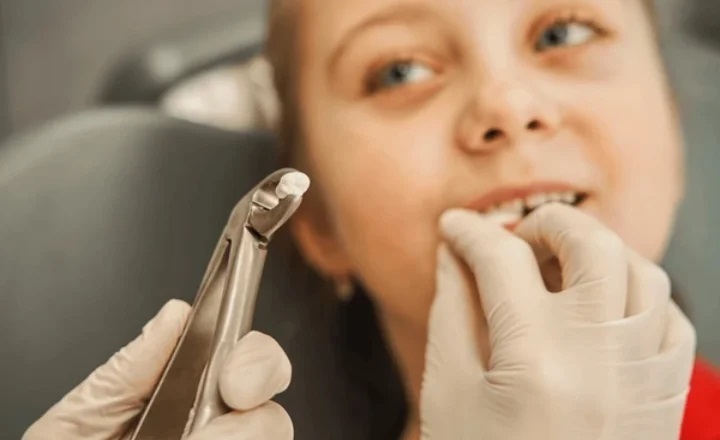 Tooth Extraction Treatment in Pune
